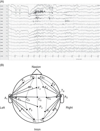 découvrez le forum pv eeg, une plateforme dédiée aux échanges et discussions autour de l'électroencéphalogramme, de ses applications et de son interprétation. rejoignez notre communauté d'experts et de passionnés pour partager vos connaissances et poser vos questions sur les dernières avancées en neurologie.
