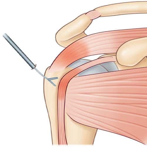 découvrez les disjonctions nocturnes, un phénomène intrigant qui perturbe le sommeil. comprenez leurs origines, leur impact sur la santé et des conseils pour mieux gérer ces troubles nocturnes.