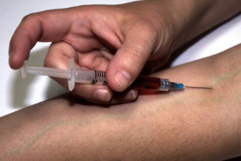 découvrez l'art de l'injection : des techniques essentielles pour optimiser vos projets et améliorer vos compétences. apprenez à maîtriser cet outil incontournable du développement moderne.