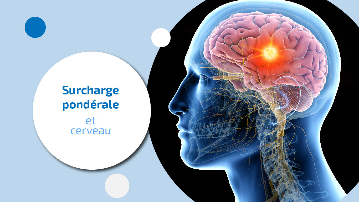 découvrez les causes et les effets de la surcharge, ainsi que des conseils pour la gérer efficacement. apprenez à reconnaître les signes de surcharge dans votre vie quotidienne et trouvez des solutions pour retrouver équilibre et bien-être.