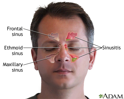 découvrez tout sur les sinus : leur fonction, les maladies courantes, et comment prendre soin de votre santé respiratoire. informez-vous sur les traitements et remèdes naturels pour soulager les douleurs et les congestions.