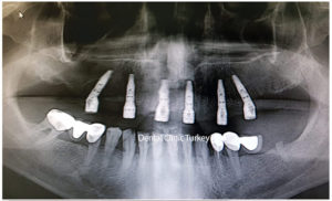 découvrez les meilleures stratégies pour maîtriser le chiffre 6 et optimiser vos performances. apprenez comment ce nombre peut influencer votre quotidien et vos choix, tout en explorant des anecdotes et des faits surprenants.